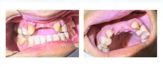 Oral cavity photograph Oral cavity photograph