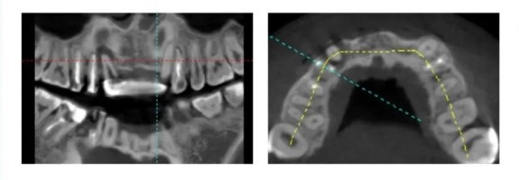 Radiological Examination-1 Radiological Examination-1