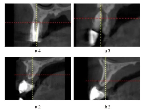 Radiological Examination-2 Radiological Examination-2