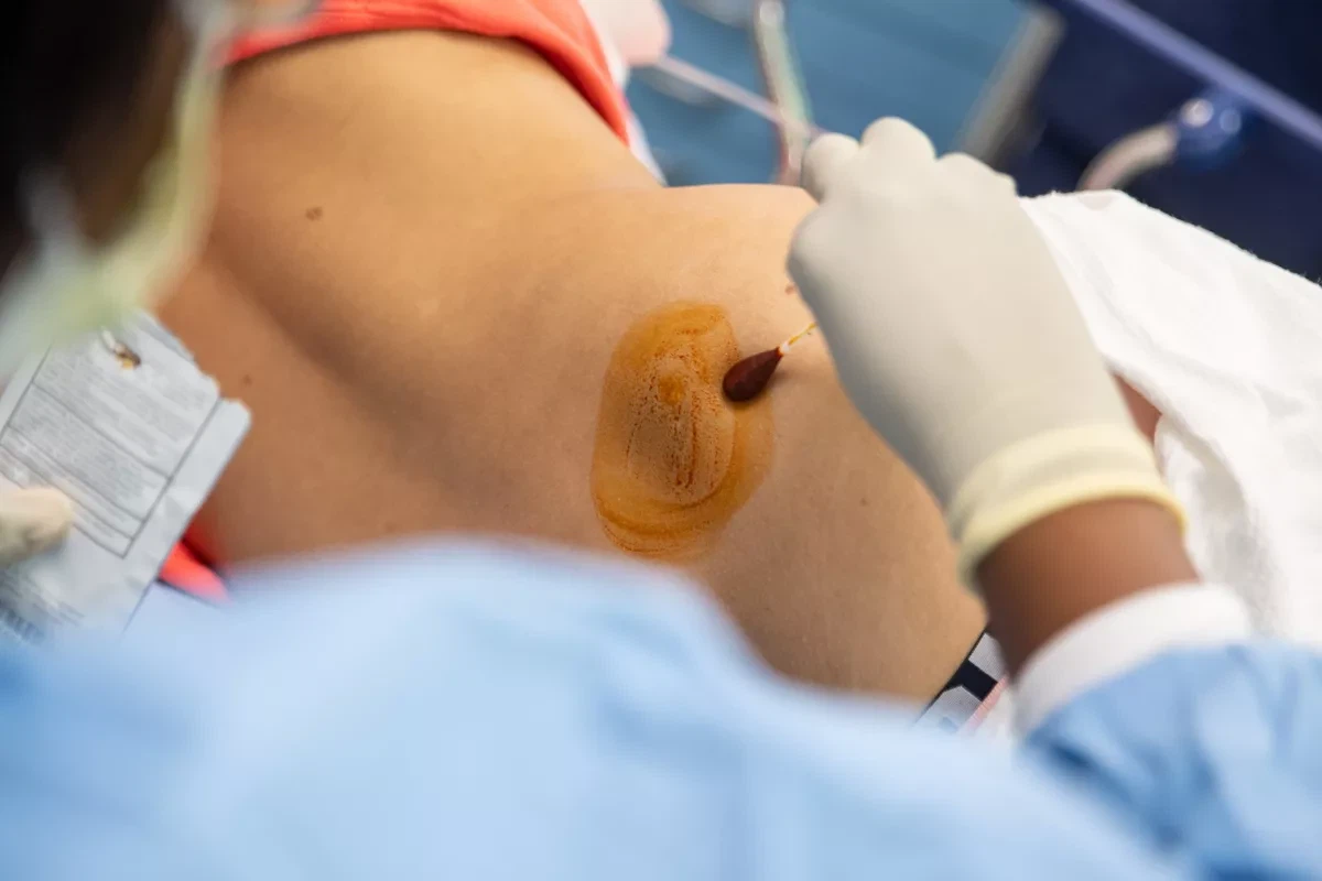 Bone Marrow Biopsy Explained: Procedure, Uses, and Recovery