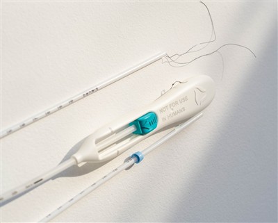 Clinical Applications Of OPU Needles in Assisted Reproductive Technology