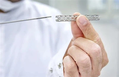 Bespoke Vascular Stent